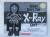 What Does the X-ray Say?