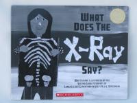 What Does the X-ray Say?