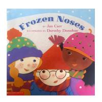 Frozen Noses
