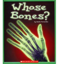 Whose Bones?
